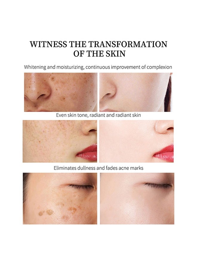 EELHOE Whitening Freckle Cream,Pigmentation Removal Cream for Face,Freckle Remover Cream,Moisturizing Anti-blemish Cream,Dark Spots Remover Skin Whitening (20g)  - Image 3