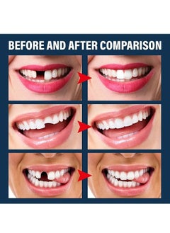 EELHOE 30ml Moldable Teeth Glue 4 Dental Tools Temporary Tooth Filling Set Difficult to Deform Smile Confidently  - Image 2