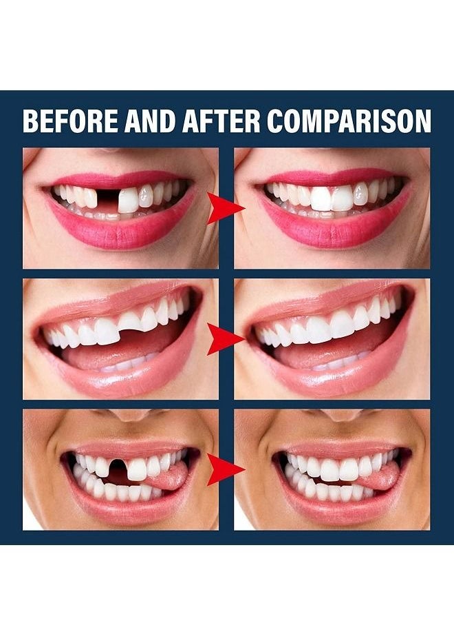 EELHOE - 30ml Moldable Teeth Glue 4 Dental Tools Temporary Tooth Filling Set Difficult to Deform Smile Confidently - Image 1