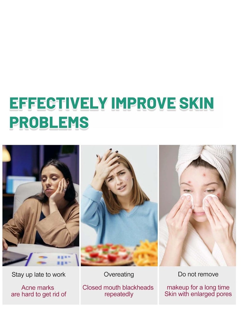 Sefudun Fruit Acid Face Serum, Dark Spot Remover & Hydrating Serum with Hyaluronic Acid, Fruit acid essence, Evens Skin Tone, Reduces Wrinkles, Korean Skin Care, 30ml - Image 3