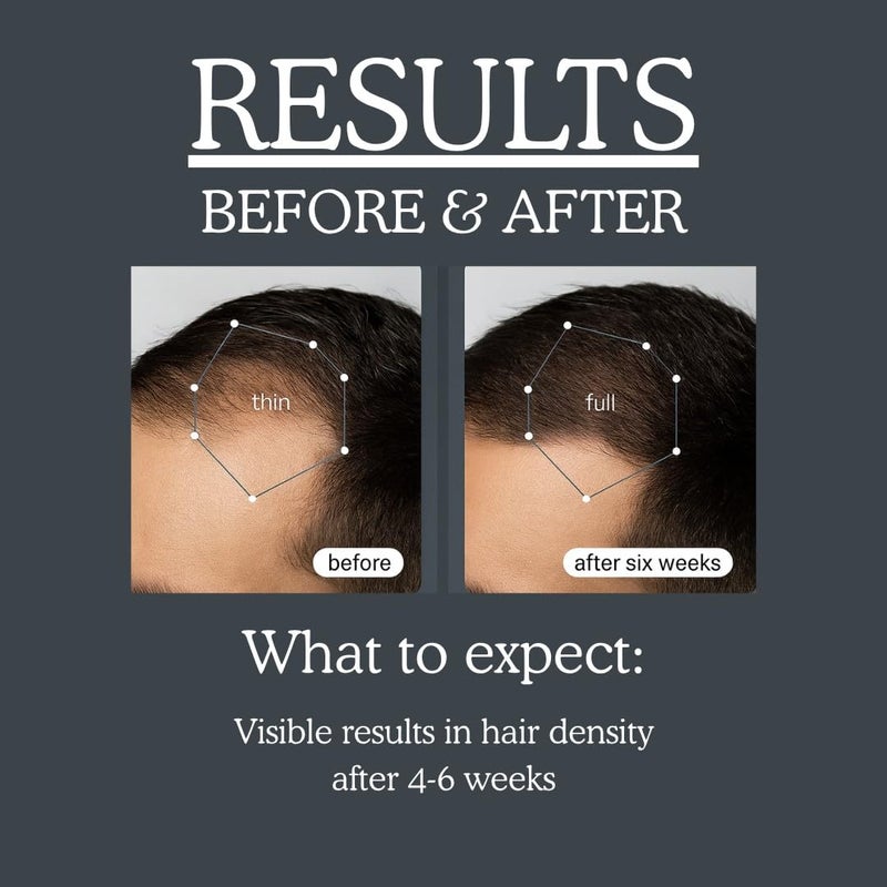 TRENDSTARTER - TEA TREE & BIOTIN THICKENING CONDITIONER (10.14Fl.Oz) - Argan Oil, Peppermint, Collagen, Quinoa, Aloe, Rosemary, Green Tea, and Saw Palmetto - All-Day Nourishing Formula - Image 3