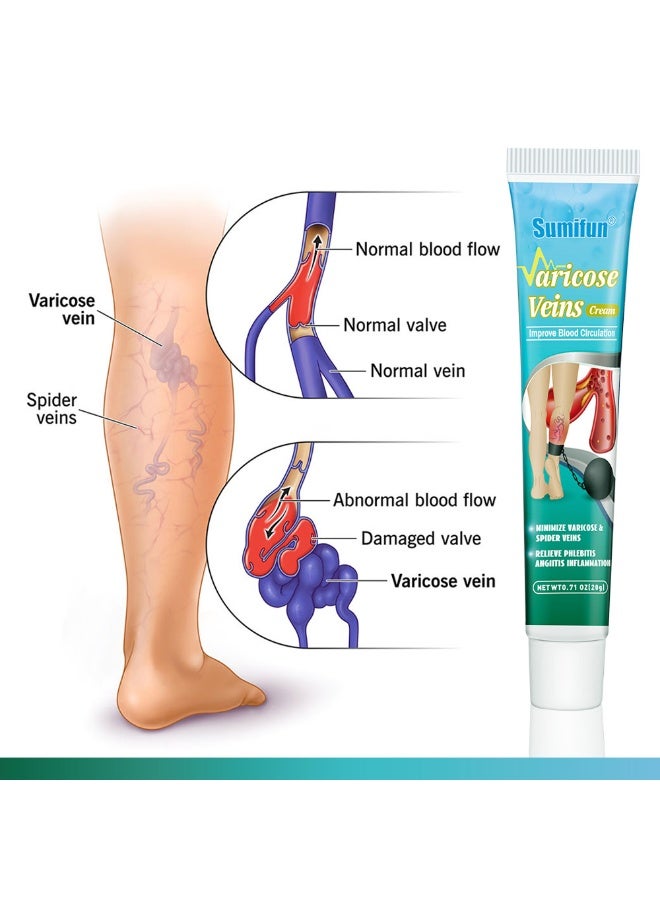 سوميفون كريم الدوالي لتخفيف الدوالي وتحسين الدورة الدموية - Image 4