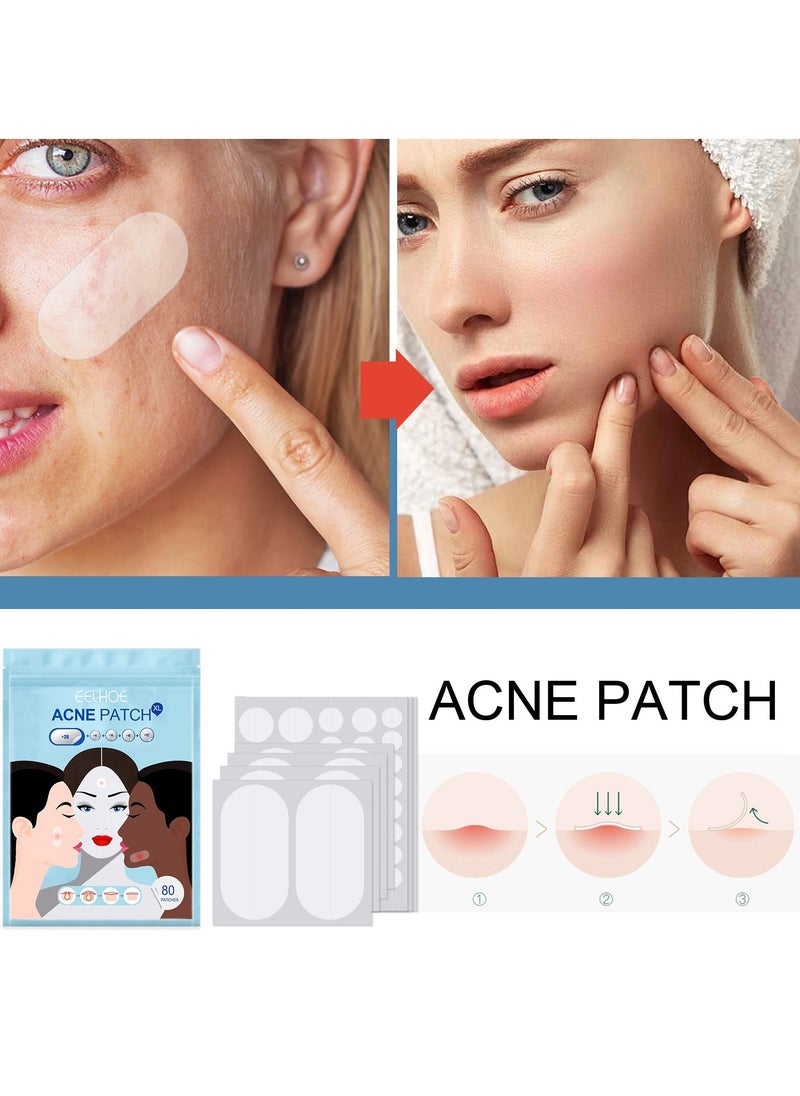 EELHOE Large Pimple Patches (5 Sizes 80 Patches), Acne Patches for Face, Chin, Back or Body, Hydrocolloid Patches Suitable for All Skin Types - Image 2