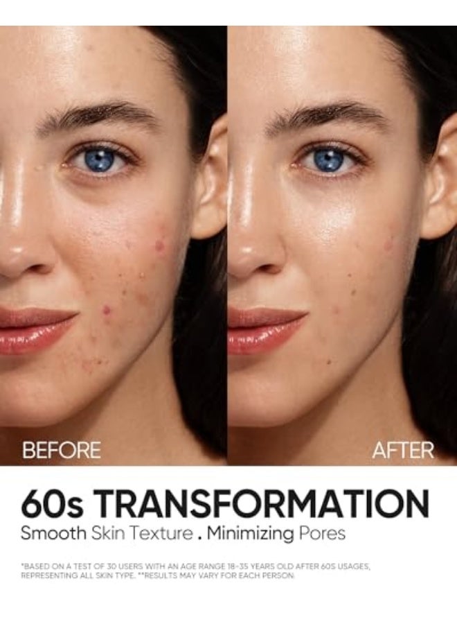 سكينتفيك محلول تقشير 12% AHA BHA PHA LHA، علاج حب الشباب بحمض الجليكوليك للوجه، سيروم تقشير مقشر للبشرة الباهتة والخشنة والدهنية مع المسام المسدودة والخلايا الميتة - Image 5