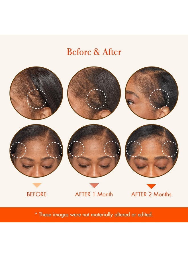 ريد باي كيس زيت تقوية الشعر RED by Kiss مع زيوت طبيعية 100% وعضوية معتمدة من وزارة الزراعة الأمريكية لفروة الرأس ونمو الشعر  - Image 5