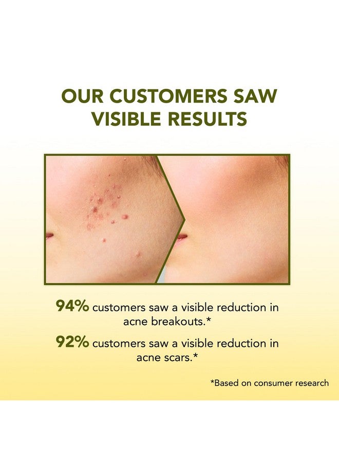 Bella Vita Organic BELLAVITA Salicylic Acid & Niacinamide Anti-Acne Face Wash | Power of 6 Actives | Treats Active Acne for Pimples | Sulphate & Paraben Free | Oily & Acne Prone Skin | 100 ml - Image 5