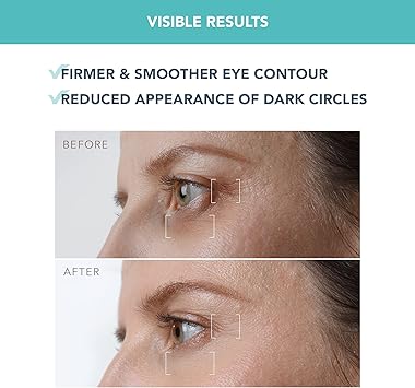 FOREO FOREO IRIS Firming Eye Serum Retinol Serum Mushroom Extract Bakuchiol Eye Cream for Dark Circles and Puffy Eyes Dark Circles Under Eye Treatment Travel size 15ml  - Image 4