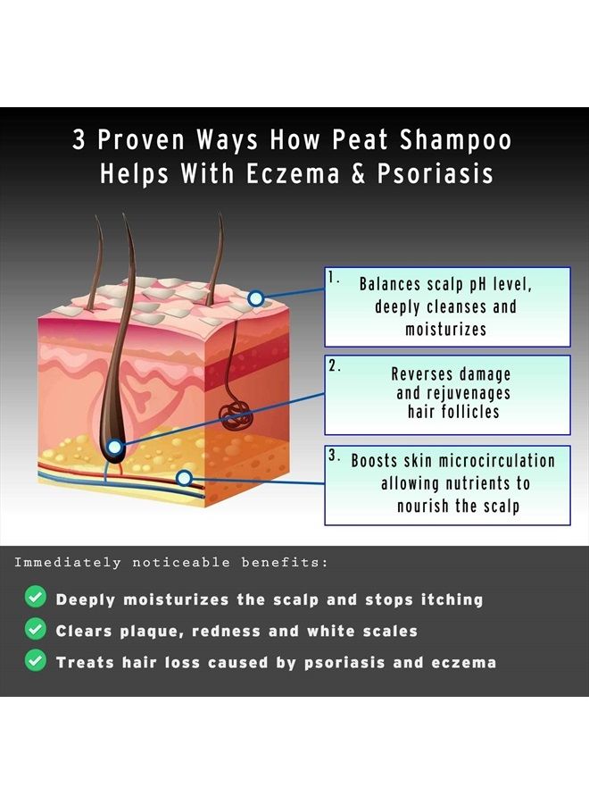 Sphagnum Botanicals Psoriasis Shampoo and Conditioner Set - Peat Mud Therapy for Itchy Scalp with Argan and Olive Oil Treatment, No Coal Tar. For Both Men and Women. 2 x 8.45 fl. Oz - Image 4