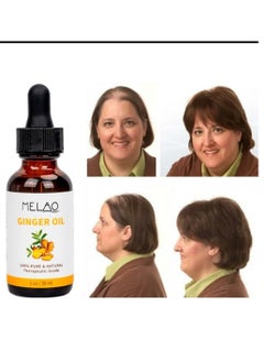 MELAO Multi-Peptide Hair Thickening Serum, Therapeutic Ginger Oil, 100% Pure & Natural  - Image 4