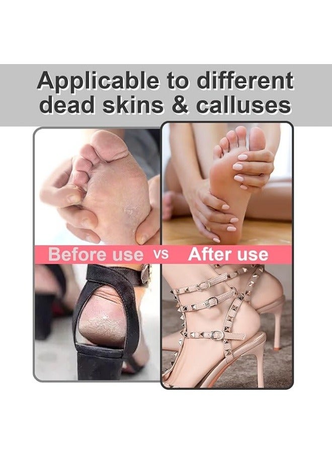 NIBEMINENT Electric Foot File - Callus Remover for Feet,Adjustable Speed Foot File with 60 Pcs Sandpaper Discs,Professional Pedicure Tool for Dead Skin and Calluses - Matte Black  - Image 4