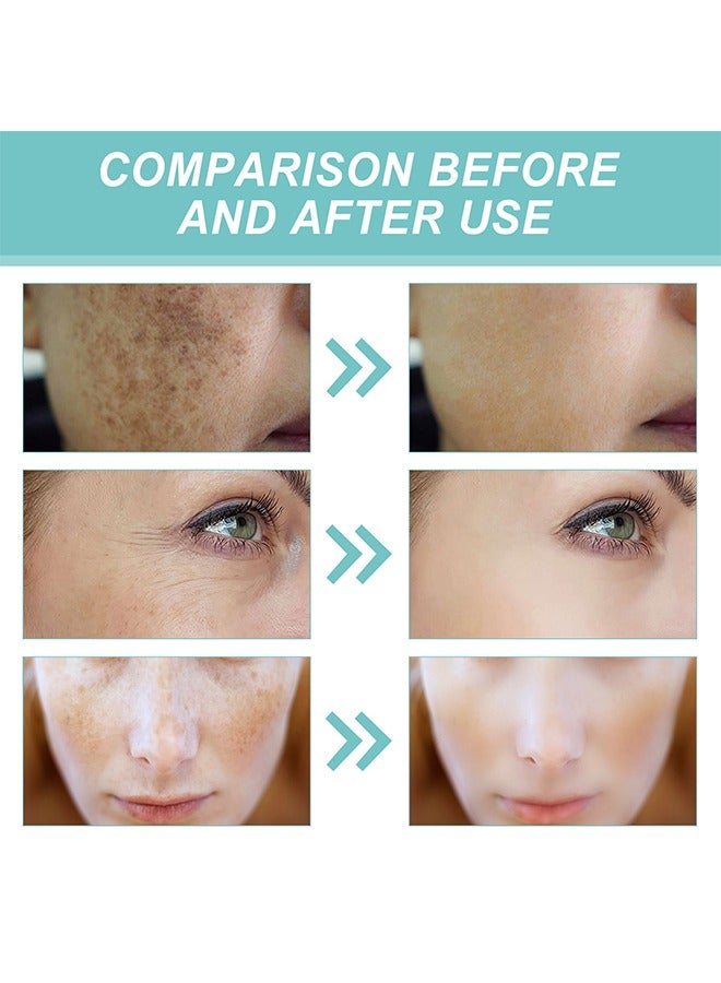 EELHOE Dark Spot Corrector - Fast Acting Dark Spot Corrector Remover For Face And Body Hyperpigmentation, Fades Melasma, Freckle, Sun Spots, Evens Skin Tone, Age Spot Remover - Image 4