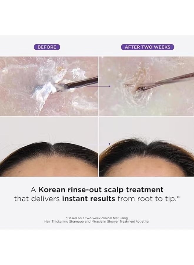 Dr.Groot Miracle in Shower Treatment for Hair Loss, Korean Hair Care, 5 Seconds to Smooth Hair, Rosemary Oil for Healthier-Looking Hair, Hair Rinse, Moisturizing Treatment,Scalp Revitalizing Solution - Image 2