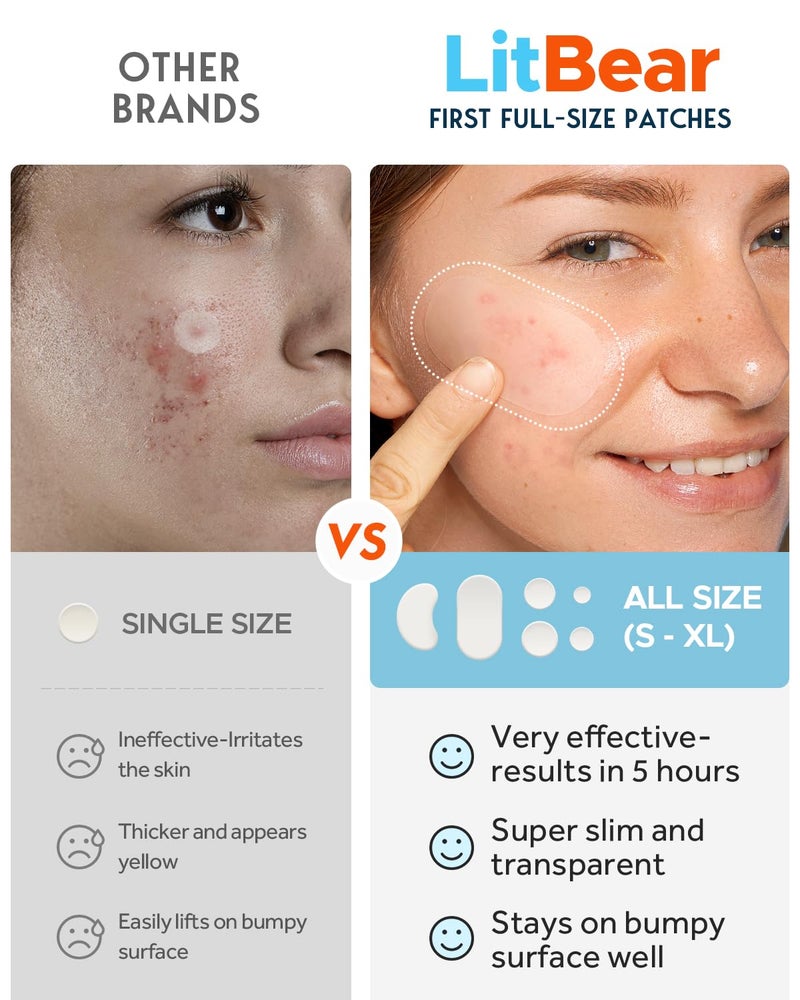 LitBear Large Acne Pimple Patches, 6 Sizes 100 Patches for Large Breakouts, Acne Patches for Face, Chin or Body, Acne Spot Patch with Tea Tree & Calendula Oil, Hydrocolloid Bandages for Acne Skin - Image 4