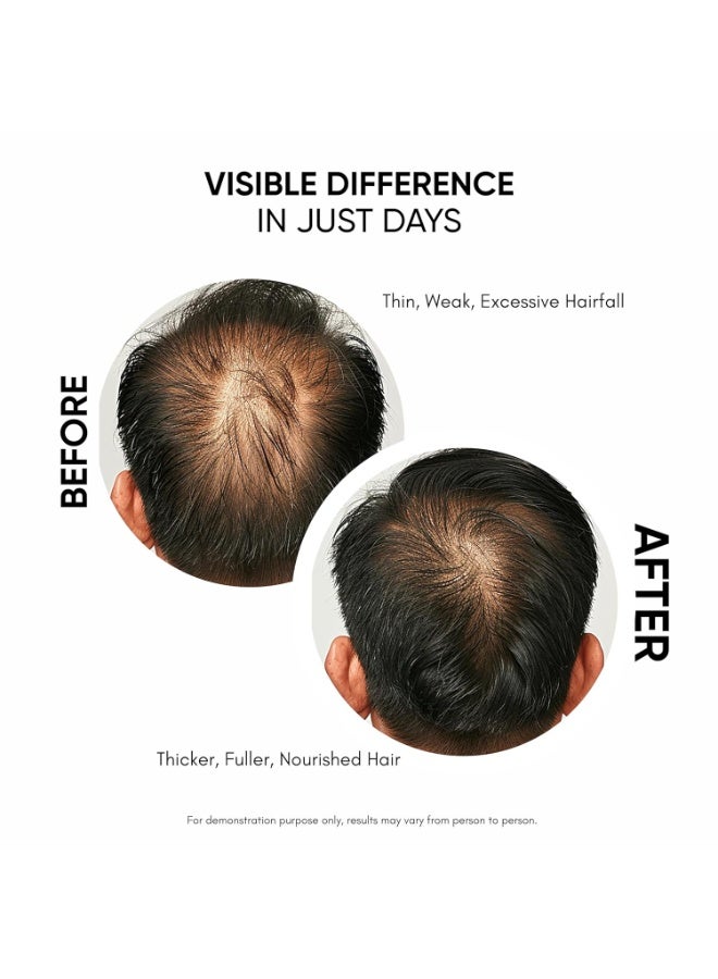 Masofta Hair Growth Serum For Promoting Hair Growth & Controlling Hair Fall With 3% Redensyl, 5% Capixyl, 4% Anagain, 3% Procapil & 3% Baicapil, Rosemary & Biotin, For Both Men & Women, 30ML - Image 3