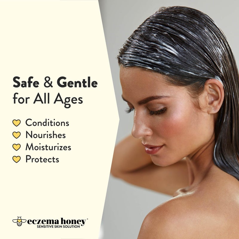 ECZEMA HONEY بلسم العسل للإكزيما - يساعد في الصدفية، التهاب الجلد، والتقشر - بلسم يومي للقشرة ورعاية فروة الرأس - علاج لفروة الرأس الحاكة للرجال والنساء والأطفال (8 أونصات) - Image 3