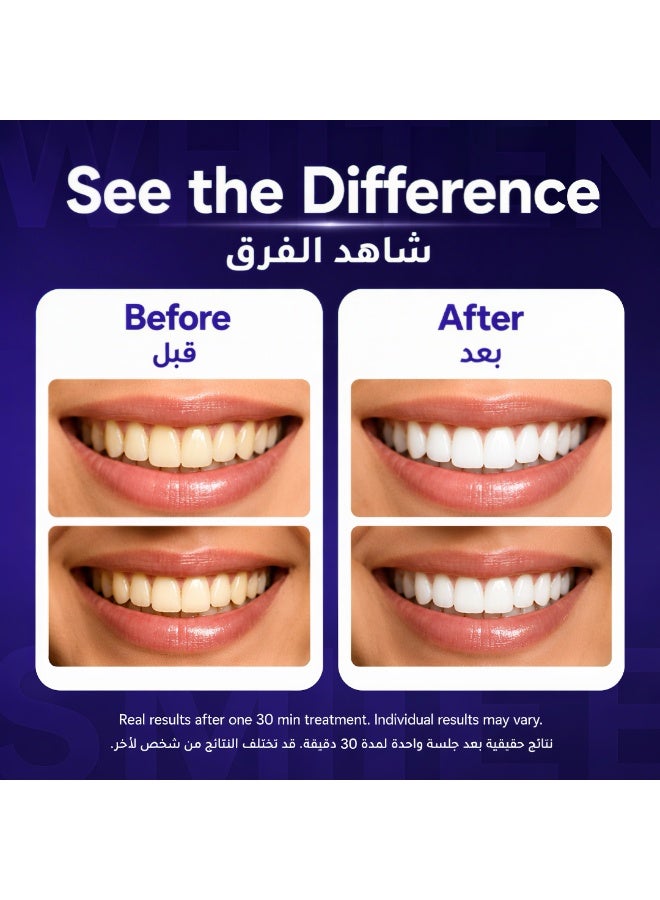 Feimuko Dent Teeth Whitening Strips, Purple Teeth Whitening Strips for Sensitive Teeth, Purple Whitening Strips for Surface Stains, Enamel Safe, Low Sensitivity, Portable Non-Slip Dry Strips, 14 Count - Image 2