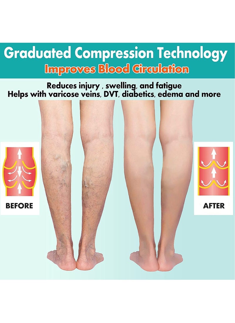 Generic - 2 Pairs Compression Socks Open Toe Compression Stockings Knee High Socks with Zipper Compression Pantyhose 15-20mmHg for Improves Blood Circulation Prevents Leg Swelling (Black) - Image 1