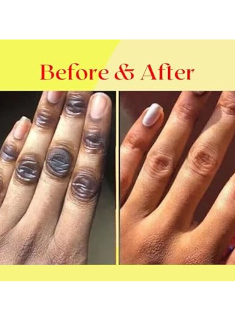 Veet 1000ML Turmeric Oil Super Whitening Body Oil, Essential Pure Oil for Skin Massage, Clear Knuckles, Dark Armpit, Thighs, Black Spots, Anti Dark Pot and Anti-aging Pure Body Diffuser Bikini Area - Image 3