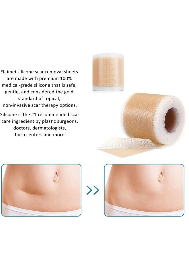 Medical Grade Silicone Scar Sheets, Silicone  Scar Tape  Scar Removal Strips for Acne Scars C-Section & Keloid Surgery Scars Sheets Treatment Sheets - 6-8 Month Supply - Image 2