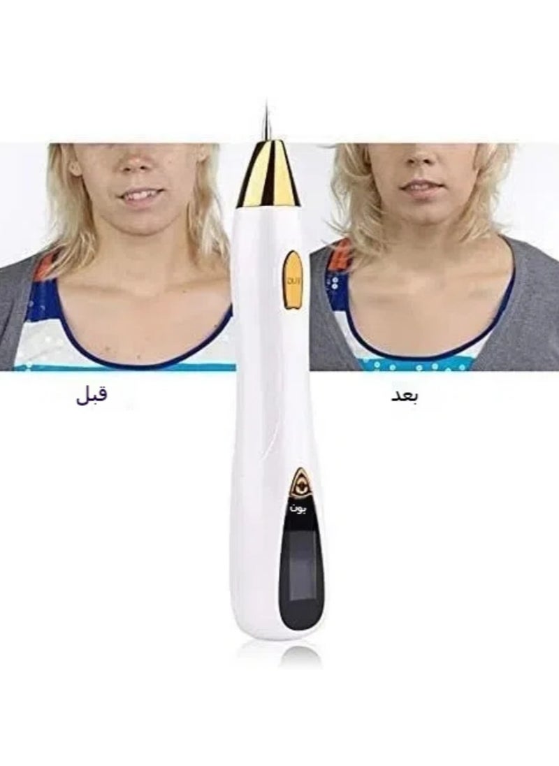General Freckle removal beauty equipment, portable safety USB rechargeable for freckles, warts, age spots, tattoos, moles, birthmarks  - Image 4