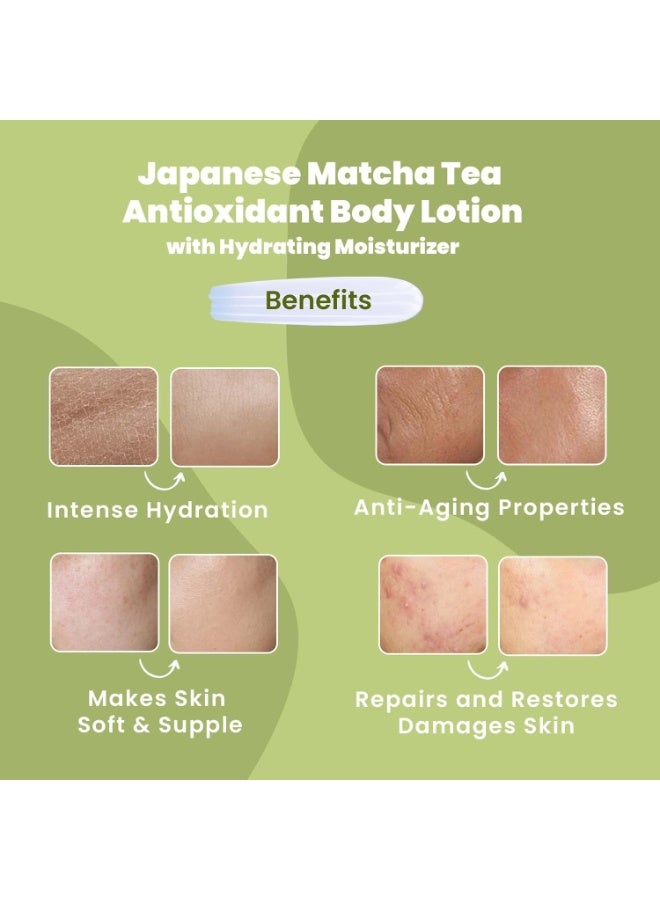 Wild Oak Japanese Matcha Tea Antioxidant Body Lotion | 5X Vitamin E, Niacinamide, Matcha, Jojoba & Almond Oil | Intense Hydration & Skin Repair | Softens, Nourishes & Locks in Moisture | Non-Greasy | 100ml - Image 3