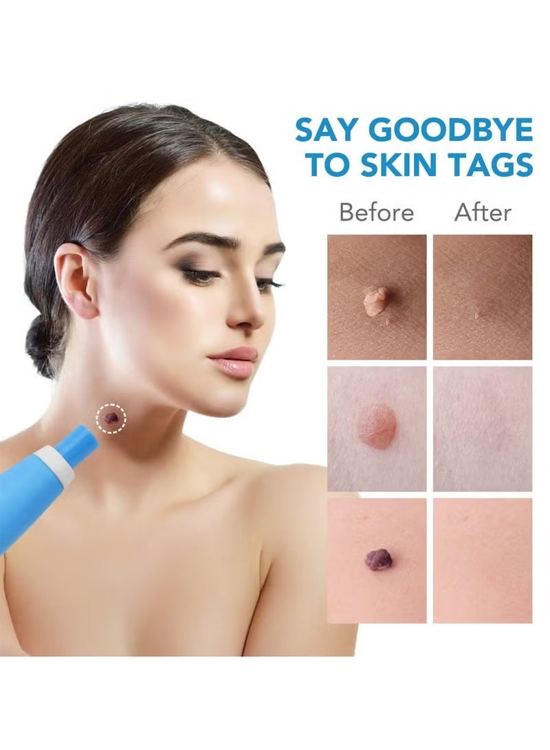 إيكيوك أداة تنظيف الثآليل والزوائد الجلدية – تصميم احترافي برأس مزدوج – أزرق - Image 3