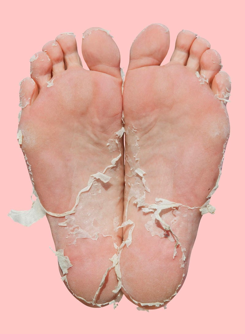 سكين ريبابلك قناع تقشير القدمين بيدي بيل (10 أزواج) - قناع تقشير القدمين مع حمض ألفا هيدروكسي وحمض التانيك والجنكة بيلوبا، يزيل الجلد القاسي والكعوب المتشققة والمسامير في 7 أيام، يحارب الرائحة، ينعم البشرة ويصلحها - Image 4