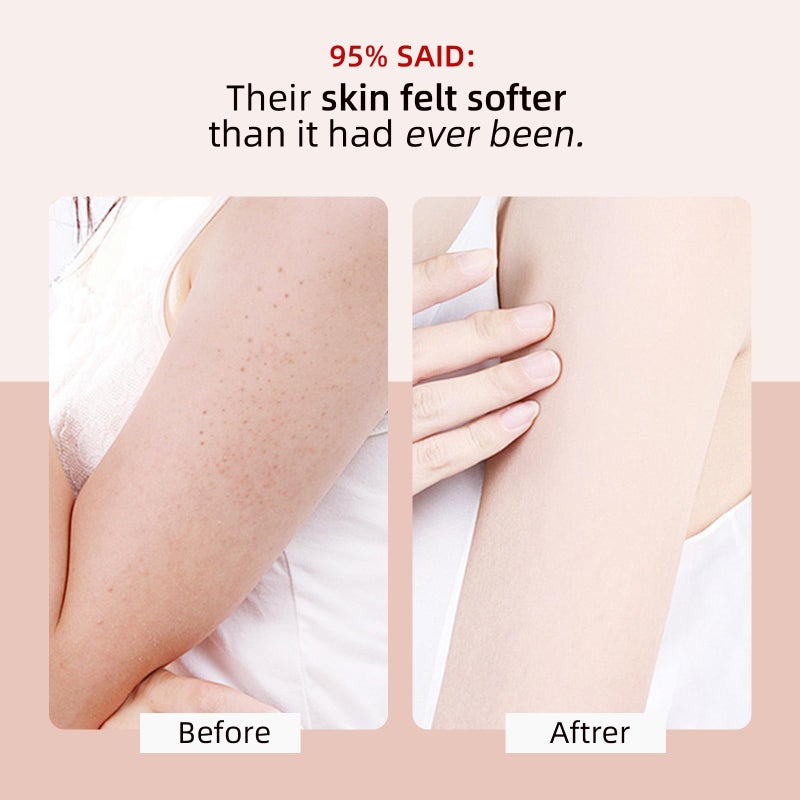 YAFUSIPE KP Bump Eraser Body Scrub with 10% AHA BHA Ingrown Hair Keratosis Pilaris Razor Bump Treatment Exfoliating Body Scrub Exfoliant Face Scrubs for Strawberry Leg Pre-shaven Blackhead 4.23OZ - Image 2