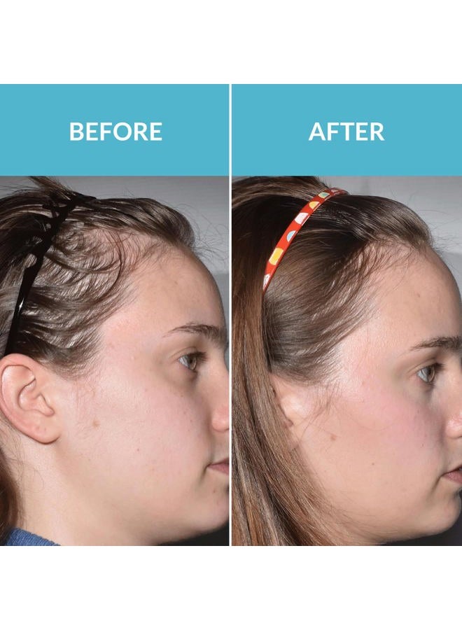 Talika سيروم هير فورس فيتو 1.6 أونصة سائلة - Image 3