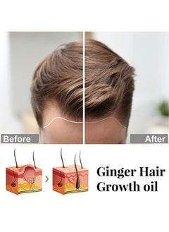 EELHOE Plant Extract Series Hair Growth Oil, Ginger Essential Oil Hair Growth, for Hair Loss, Hair Grow Thicker And Longer, Fast Hair Growth 30ml  - Image 3
