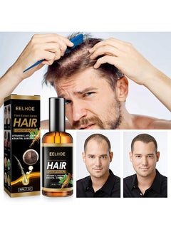 EELHOE Plant Extract Series Hair Growth Oil, Ginger Essential Oil Hair Growth, for Hair Loss, Hair Grow Thicker And Longer, Fast Hair Growth 30ml  - Image 2
