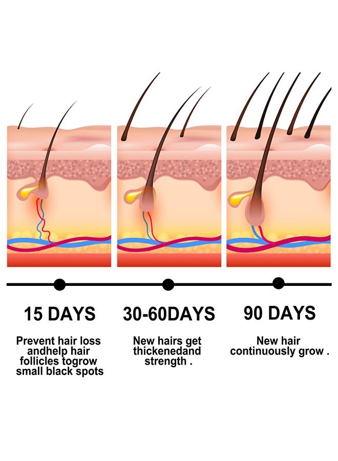 إيلهو سلسلة مستخلصات نباتية زيت نمو الشعر ، زيت الزنجبيل العطري نمو الشعر ، لتساقط الشعر ، ينمو الشعر أكثر سمكا وأطول ، نمو سريع للشعر 30 مل - Image 4