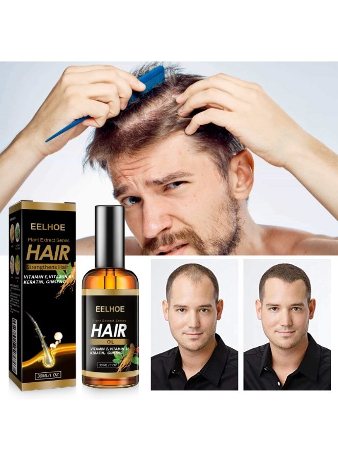 EELHOE Plant Extract Series Hair Growth Oil, Ginger Essential Oil Hair Growth, for Hair Loss, Hair Grow Thicker And Longer, Fast Hair Growth 30ml - Image 2