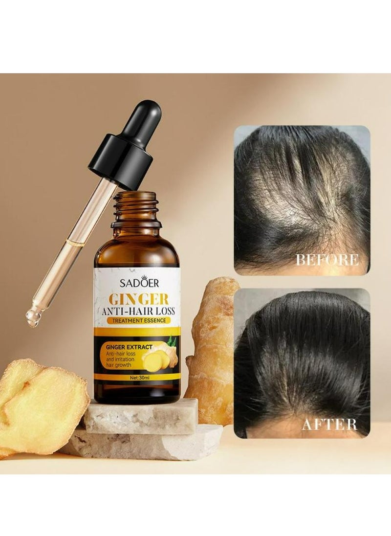 SADOER - Hair Growth Serum Ginger Essence Hair Care Oil 30 ML - Image 1