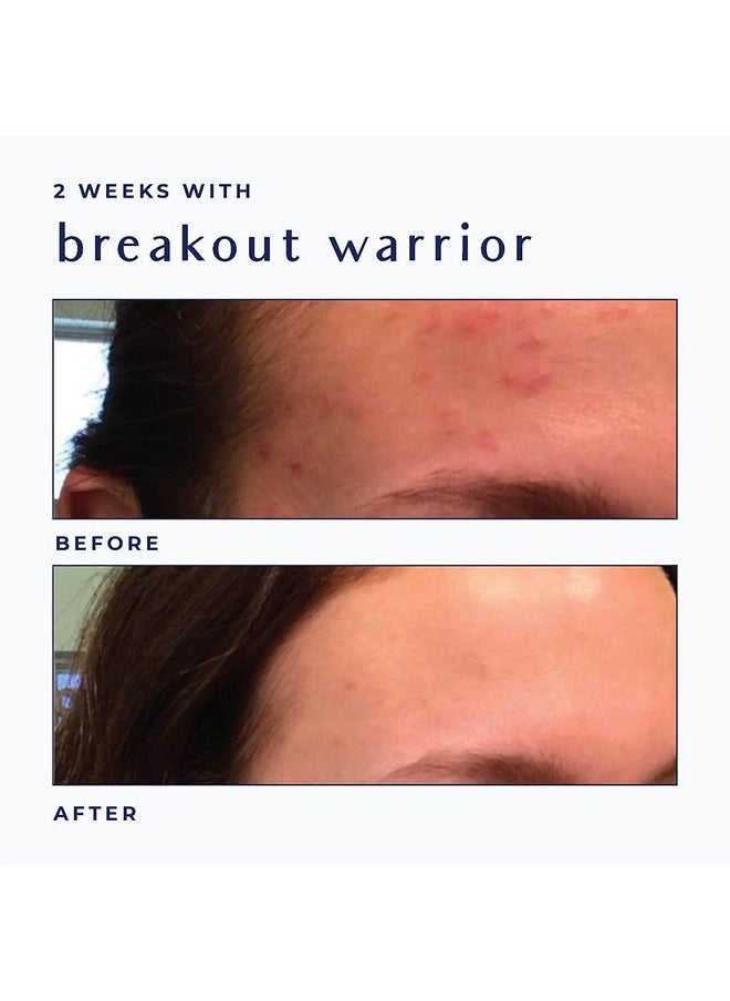 AYADARA - Moisturizing Acne Treatment Cream Salicylic Acid Face Moisturizer For Oily & Acne Prone Skin Pimple Blackhead Whitehead Hormonal & Cystic Acne Treatment For Men Women 90Day Supply - Image 1