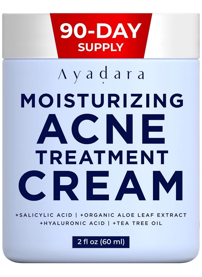 AYADARA - Moisturizing Acne Treatment Cream Salicylic Acid Face Moisturizer For Oily & Acne Prone Skin Pimple Blackhead Whitehead Hormonal & Cystic Acne Treatment For Men Women 90Day Supply - Image 1