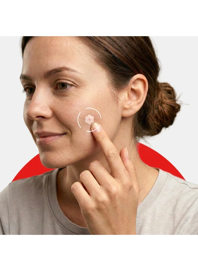 ايل ELLE Magnesium Acne Patch |Micro-Dart | Magnesium - The Magic Mineral | Deep Penetrating Hydrocolloid Pimple Patch | Early Stage & Pus Pimples | Tea Tree & Madecassic Acid | 10 Patches
