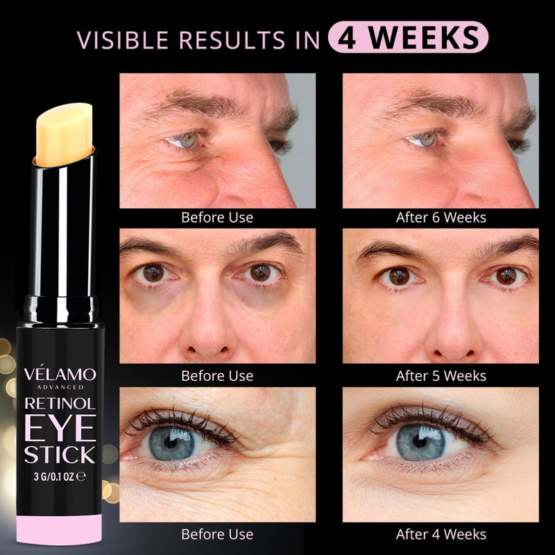 VELAMO ADVANCED Retinol Eye Stick: Retinol Eye Cream for Dark Circles and Puffiness with 1% Bakuchiol and Caffeine - Visibly Reduces Fine Lines Wrinkles Under Eye Bags with Upgraded Formula 0.1 OZ/3g - Image 5