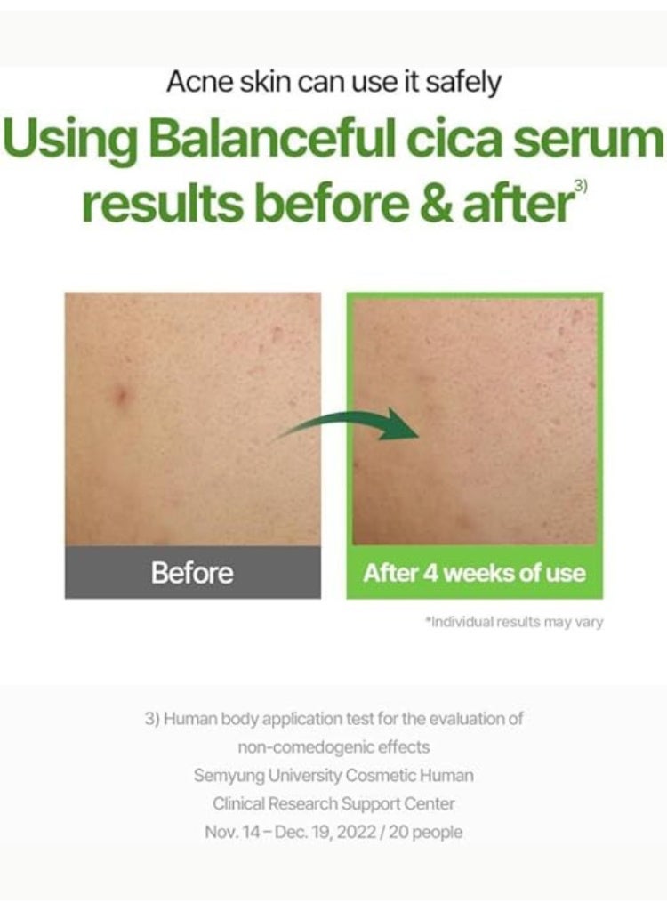 توريدن سيروم Torriden BALANCEFUL Cica لتقليل الاحمرار وتهدئة البشرة وإصلاح الحاجز اليومي - Image 4