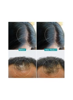 PILGRIM Redensyl 3% Anagain 4% Advanced Hair Growth Serum For Women And Men 50ml  - Image 5