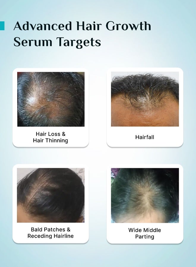 PILGRIM Redensyl 3%+Anagain 4% Advanced Hair Growth Serum(50Ml) For Scalp With Natural Ingredients Korean Black Rice,Controls Hair Fall,Increases Hair Density Hair Growth Serum For Unisex - Image 5