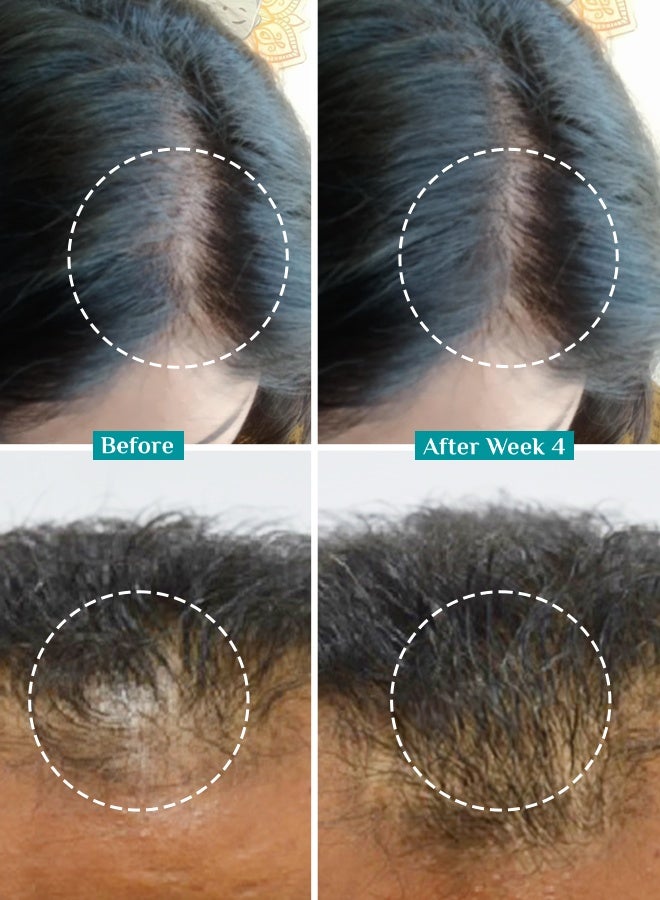 PILGRIM Redensyl 3%+Anagain 4% Advanced Hair Growth Serum(50Ml) For Scalp With Natural Ingredients Korean Black Rice,Controls Hair Fall,Increases Hair Density Hair Growth Serum For Unisex - Image 4