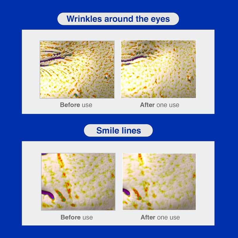 IOPE Retinol Serum in Deep Collagen Gel Mask 51 Set DoubleLayered Hydrogel Sheet for High Adhesion A Full Bottle of Retinol RX 1 Serum Intense Firming Plumping AntiAging Korean Skincare - Image 4