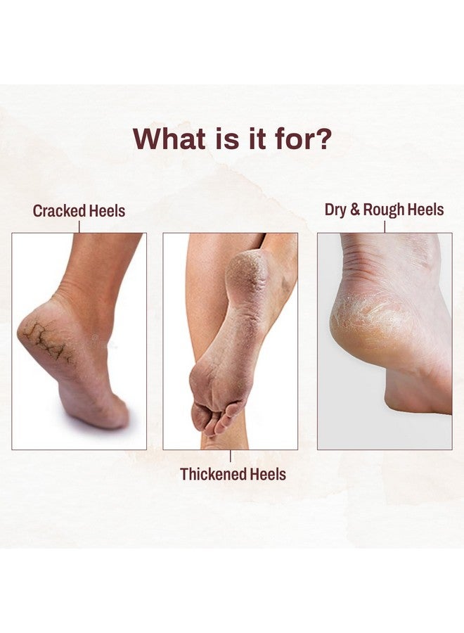 OUKEYA 20% Urea Foot Roll On Cracked Heel Repair Feet Cream 50 Ml Foot cream, Foot Care For Diabetic, For Dry & Cracked Feet, Moisturizes & Soothes Feet, Heel Repair, For Calloused, or Chapped Skin Foot Cream For Rough, Dry and Cracked Heel, With 2% Lactic Acid, Olive Oil & Vitamin E - Image 3