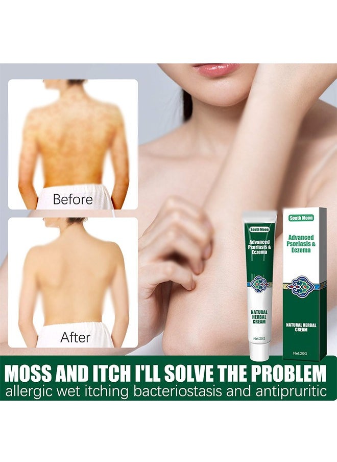 SOUTH MOON - Advanced Psoriasis&Eczema Natural Herbal Cream，Organic Eczema Herbal Healing Cream, Chinese Herbal Eczema, Natural Herbal Cream, Psoriasis Ointment Cream, Moisturising Cream, Face Cream, Body Cream for Dry Skin, Itch Skin, Itch Relief Cream 20G - Image 1