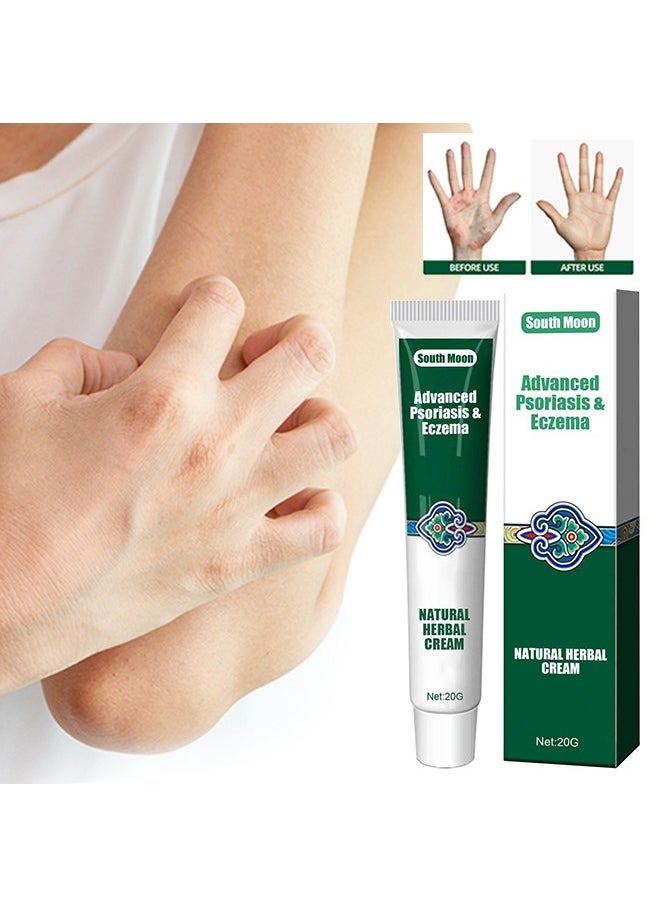 SOUTH MOON - Advanced Psoriasis&Eczema Natural Herbal Cream，Organic Eczema Herbal Healing Cream, Chinese Herbal Eczema, Natural Herbal Cream, Psoriasis Ointment Cream, Moisturising Cream, Face Cream, Body Cream for Dry Skin, Itch Skin, Itch Relief Cream 20G - Image 1