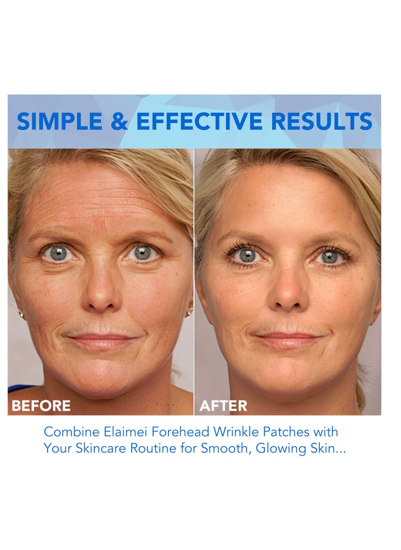 Elaimei - Forehead Wrinkle Patch - 16Pcs Collagen-Infused Anti Wrinkle Patches for Smoother Skin - Anti-aging Facial Pads for Forehead Lines with Vitamin Enriched Formula - Image 1