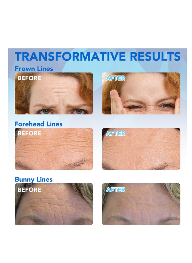 Elaimei - Forehead Wrinkle Patch - 16Pcs Collagen-Infused Anti Wrinkle Patches for Smoother Skin - Anti-aging Facial Pads for Forehead Lines with Vitamin Enriched Formula - Image 1