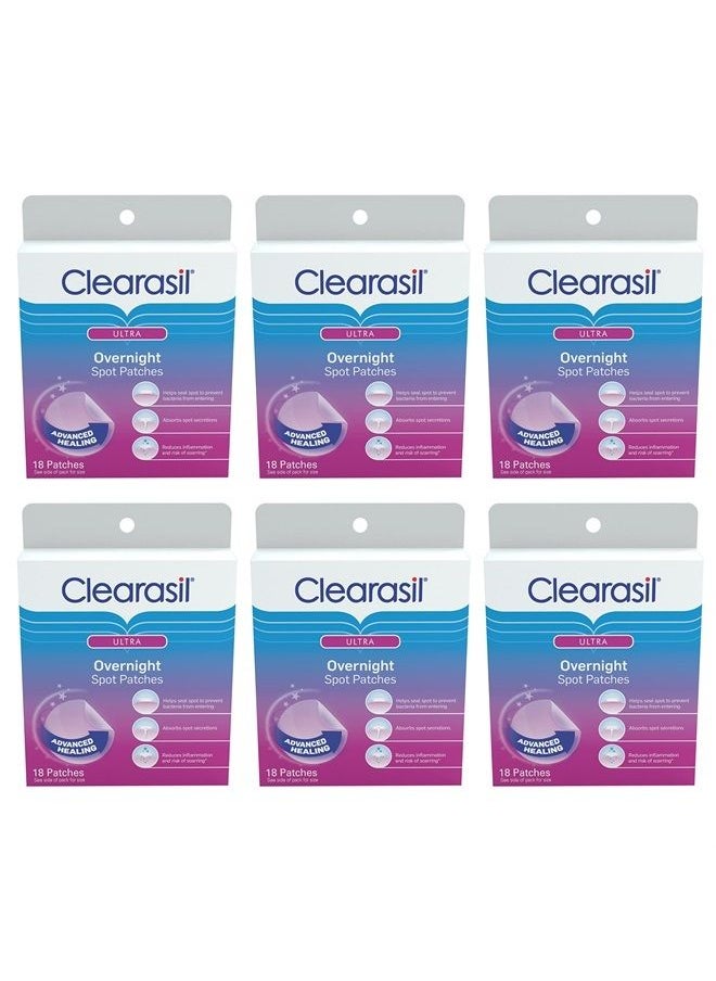 Clearasil - Overnight Spot Patches, Advanced Healing Hydrocolloid Acne Pimple Treatment, Blemish Spot Stickers for Face, 18 Count (Pack of 6) - Image 1