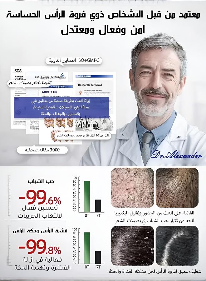 شامبو طبي مضاد للقشرة بتركيبة السيلينيوم ثنائي الكبريت، لتهيج فروة الرأس والتحكم في الزيوت وتقوية الشعر - Image 4